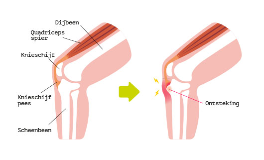 Osgoof Schlatter