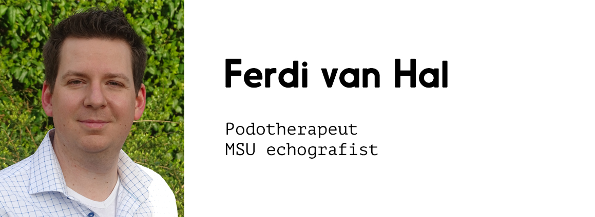 Ferdi